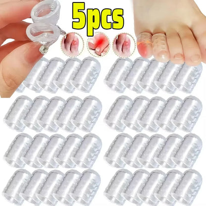 Transparent Soft Silicone Toe Caps – Anti-Friction Blister Protector for Foot Pain Relief and Foot Care
